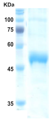 Dengue type 3 NS1 protein (insect cell)