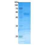 Dengue type 4 NS1 protein (insect cell)