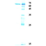 Influenza A nucleoprotein