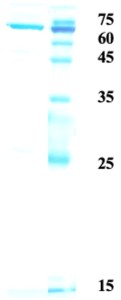 Influenza A nucleoprotein