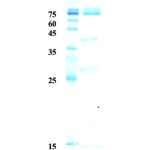 Influenza B nucleoprotein