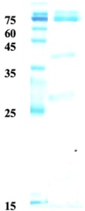 Influenza B nucleoprotein Influenza B nucleoprotein