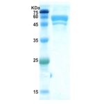 Hepatitis A virus (HAV) chimeric protein