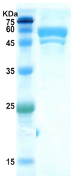 Hepatitis A virus (HAV) chimeric protein