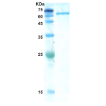 Hepatitis C virus (HCV) NS3 protein  (AA1192-1574)