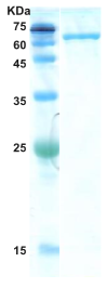 Hepatitis C virus (HCV) NS3 protein  (AA1192-1574)