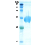 Hepatitis C virus (HCV) NS3 protein  (AA1192-1457)