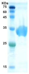 Hepatitis C virus (HCV) NS3 protein  (AA1192-1457)