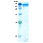 Hepatitis C virus (HCV) core/NS3 protein 