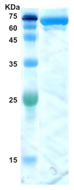 Hepatitis C virus (HCV) core/NS3 protein 