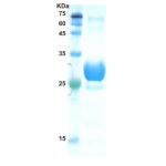 Hepatitis C virus (HCV) core protein 