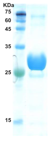 Hepatitis C virus (HCV) core protein 