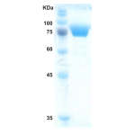 Hepatitis C virus (HCV) core/NS3/NS4/NS5 protein (capture)