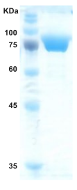 Hepatitis C virus (HCV) core/NS3/NS4/NS5 protein (capture)