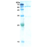 HIV-1 gag p24 protein