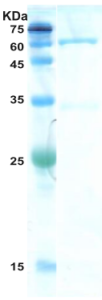 HIV-1 gag p24 protein
