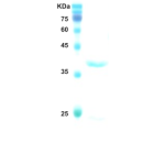 HIV-1 envelope gp120/gp41 protein