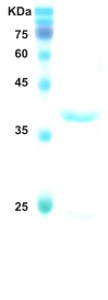 HIV-1 envelope gp120/gp41 protein