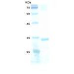 HIV-2 envelope gp36 protein