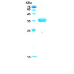 HIV-1 envelope gp120/gp41 protein