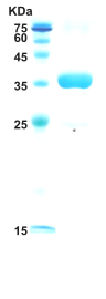 HIV-1 envelope gp120/gp41 protein