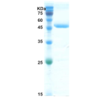 HIV-1 envelope gp120/gp41 protein (capture)