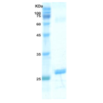 HIV-1 gag p24 protein