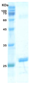 HIV-1 gag p24 protein