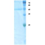 HTLV-1 envelope gp43/gp21 protein