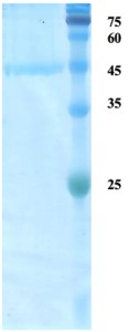 HTLV-1 envelope gp43/gp21 protein