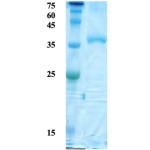 HTLV-2 envelope gp21 protein 