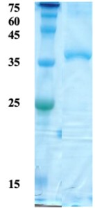 HTLV-2 envelope gp21 protein 