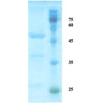 HTLV-2 envelope gp21 protein 