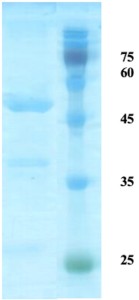 HTLV-2 envelope gp21 protein 