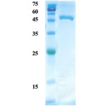 Helicobactor pylori (H. pylori) CagA protein (capture)