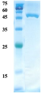 Helicobactor pylori (H. pylori) CagA protein (capture)