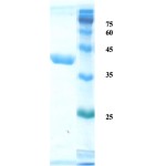 Helicobactor pylori (H. pylori) CagA protein (capture/detection)