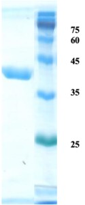 Helicobactor pylori (H. pylori) CagA protein (capture/detection)