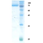 Helicobactor pylori (H. pylori) catalase (KatA) protein 