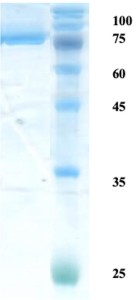 Helicobactor pylori (H. pylori) catalase (KatA) protein 