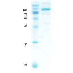 Helicobactor pylori (H. pylori) catalase (KatA) protein