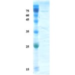 Helicobactor pylori (H. pylori) VacA protein