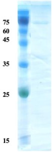 Helicobactor pylori (H. pylori) VacA protein