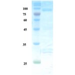 Helicobactor pylori (H. pylori) UreB protein