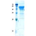 Leishmania K28 protein (capture)