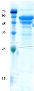 Leishmania K28 protein (capture) Leishmania K28 protein (capture)