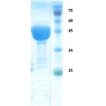 Leishmania K9-26-39 protein