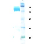 Leishmania K39 protein 