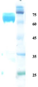 Leishmania K39 protein Leishmania K39 protein