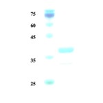 Leishmania K28 protein (detection)